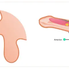 Illustration zeigt, wie ein zu enger penisring den Blutfluss behindert. Arterien werden komprimiert, Venen gestaut.