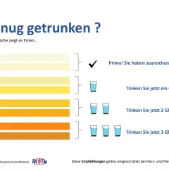Die Urinfarbe zeigt, ob Sie genug getrunken haben. Helle Töne bedeuten, Sie sind gut hydriert. Dunklere Töne erfordern mehr Wasser.