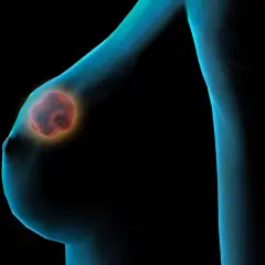 Ein leuchtender, roter Knoten in der Brust, dargestellt als 3D-Modell.