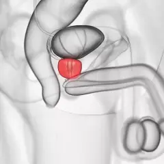 Männliche Anatomie: Harnblase, Prostata (rot hervorgehoben) und Penis. Ein Leben ohne Prostata ist möglich.