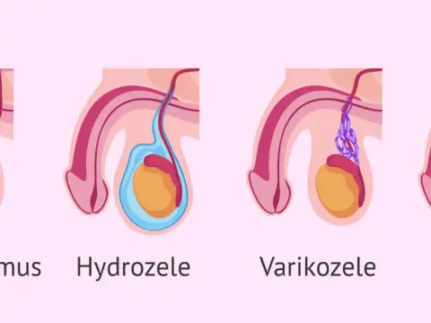 Hoden kleiner? Ursachen, Potenz & Fruchtbarkeit – Wann zum Arzt?