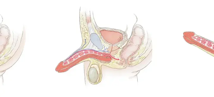 Anatomische Darstellung des Penis in drei Stadien der Erektion. Die Bilder zeigen, wie sich die Blutgefäße füllen, was zu den sexuellerregt Symptomen Mann führt.