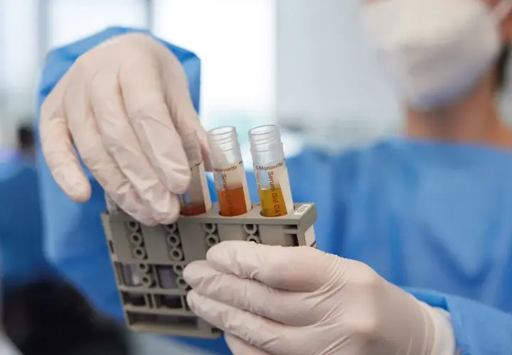 Laborant hält Röhrchen mit Serum. Blutbild kann bei Darmkrebs Anzeichen aufzeigen.