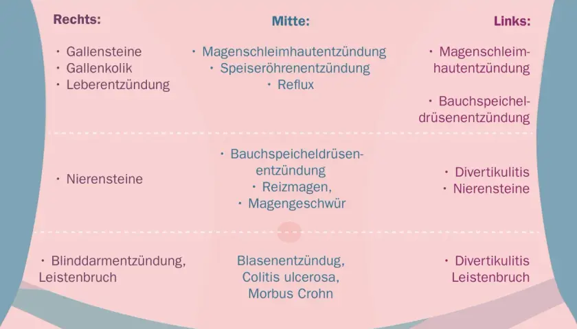 Ursachen für Schmerzen im rechten Unterbauch: Gallensteine, Gallenkolik, Leberentzündung, Nierensteine, Blinddarmentzündung, Leistenbruch.