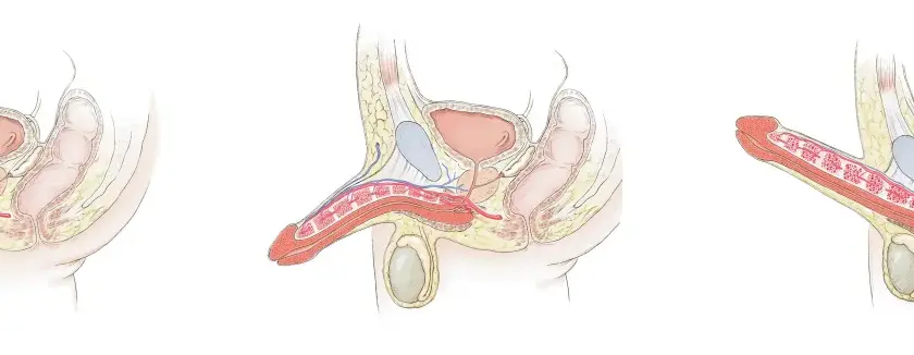 Anatomische Darstellung des Penis in drei Stadien der Erektion. Die Bilder zeigen, wie sich die Blutgefäße füllen, was zu den sexuellerregt Symptomen Mann führt.