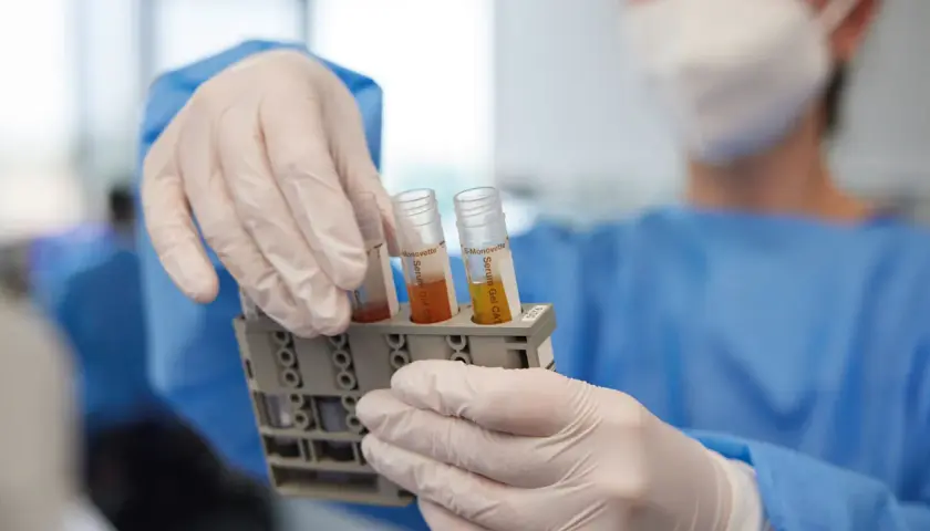 Laborant hält Röhrchen mit Serum. Blutbild kann bei Darmkrebs Anzeichen aufzeigen.