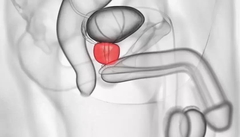 Männliche Anatomie: Harnblase, Prostata (rot hervorgehoben) und Penis. Ein Leben ohne Prostata ist möglich.
