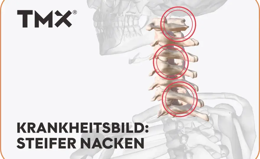 Nackensteife: Ursachen, Hilfe & Vorbeugung – Dein Guide