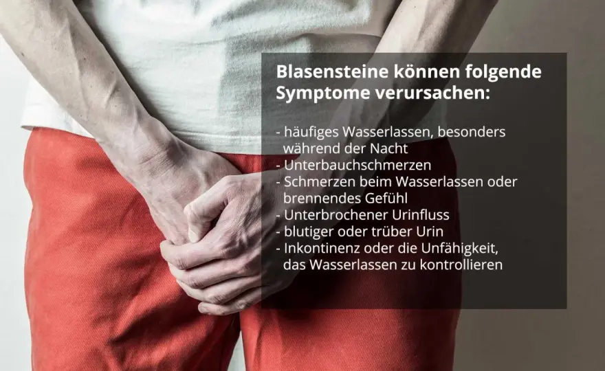 Blasensteine Symptome - Wann ist es ernst?