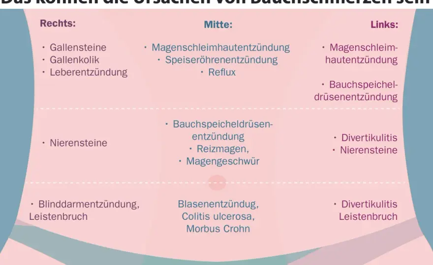 Rechter Unterbauchschmerz - Wann zum Arzt?