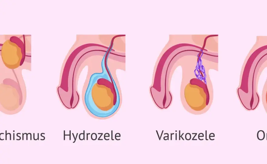 Hoden kleiner? Ursachen, Potenz & Fruchtbarkeit – Wann zum Arzt?