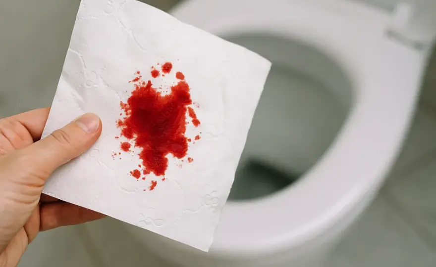 Blut am Toilettenpapier - Wann harmlos, wann zum Arzt?