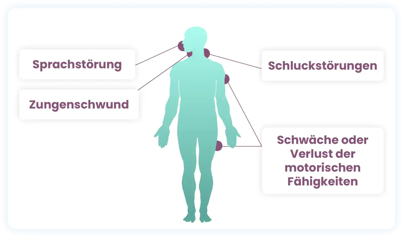 Menschliche Silhouette mit Markierungen für Sprachstörung, Zungenschwund, Schluckstörungen und Schwäche/Verlust motorischer Fähigkeiten als Symptome.