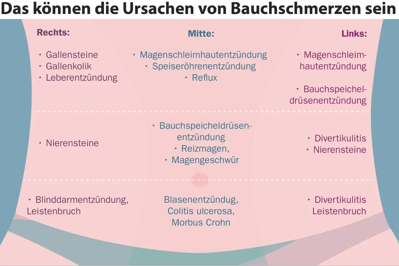 Ursachen für Schmerzen im rechten Unterbauch: Gallensteine, Gallenkolik, Leberentzündung, Nierensteine, Blinddarmentzündung, Leistenbruch.