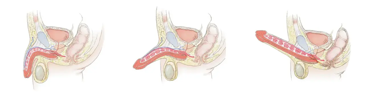 Anatomische Darstellung des Penis in drei Stadien der Erektion. Die Bilder zeigen, wie sich die Blutgefäße füllen, was zu den sexuellerregt Symptomen Mann führt.