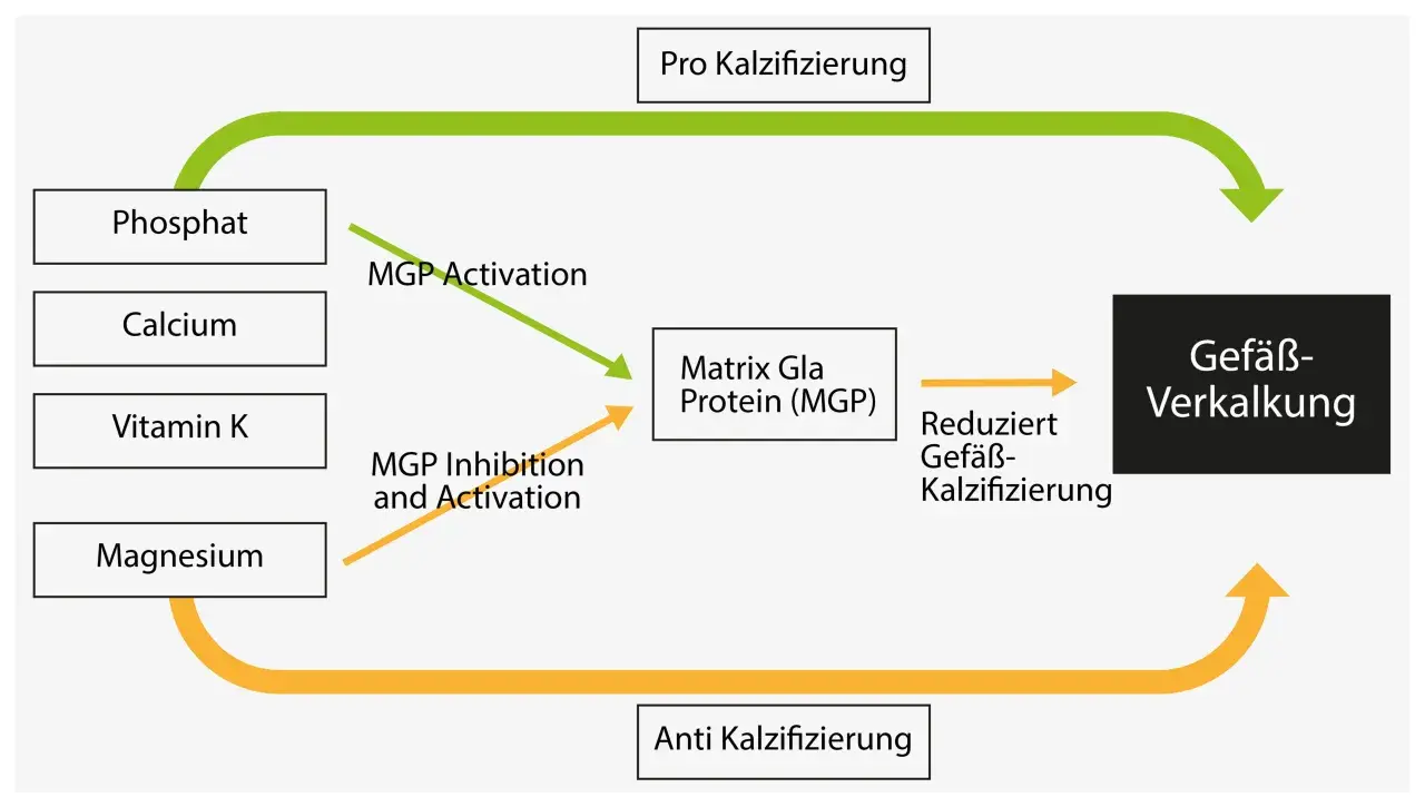 Schema zeigt, wie Vitamin K, Kalzium und Phosphat die Gefäßverkalkung beeinflussen. Vitamin K aktiviert MGP, was Gefäßverkalkung reduziert.