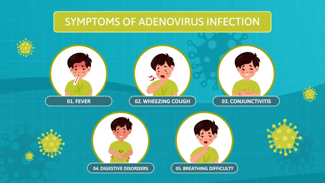 Illustration zeigt typische adenovirus symptome erwachsene: Fieber, Husten, Bindehautentz&uuml;ndung, Verdauungsprobleme und Atembeschwerden.