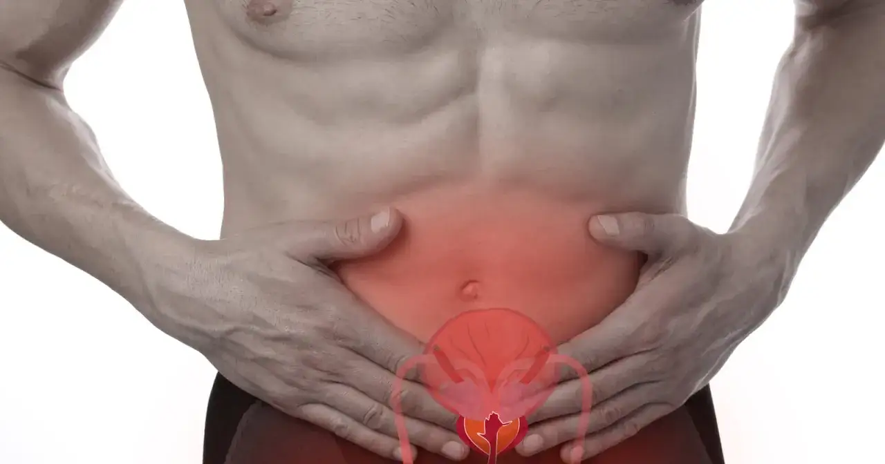 Mann hält sich den Unterbauch, wo eine Blase mit roten Schmerzen dargestellt ist. Mögliche blasensteine symptome.