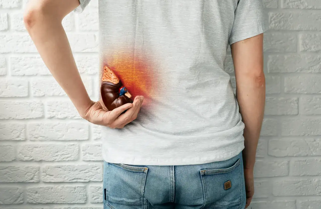 Person hält ein Modell einer Niere, die von roten Flammen umgeben ist, was auf starke Nierensteine Schmerzen hindeutet.